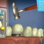 Dental Surgery 1