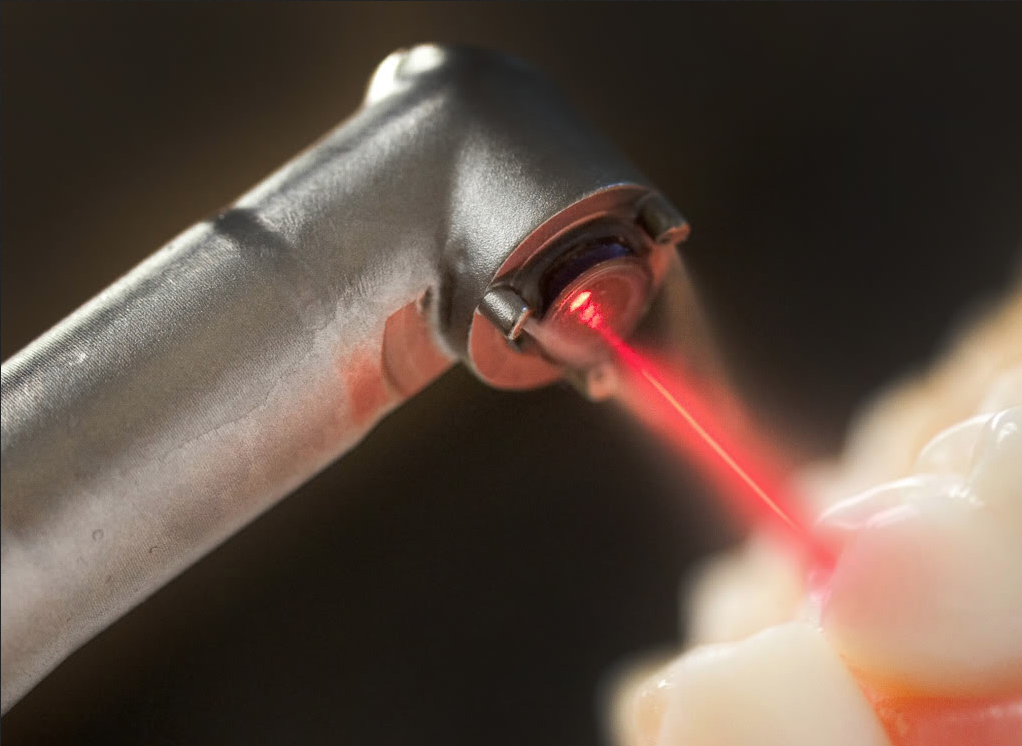 laser dentistry1