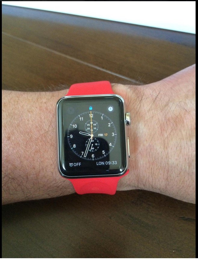 Apple Watch1