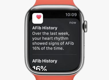 watchos 9 afib history