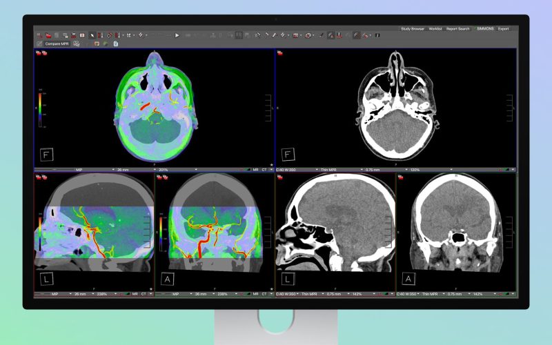 studio display xdr medical presets